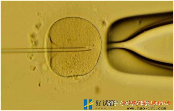 用7张图还原试管婴儿的全过程(图9)
