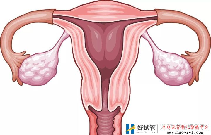 做试管婴儿对身体有什么危害(图3) 做试管婴儿对身体有什么危害(图3)