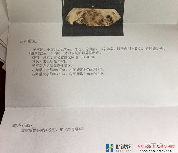 试管婴儿究竟有多痛苦,一个试管妈妈含泪分享经验(图2) 试管婴儿究竟有多痛苦,一个试管妈妈含泪分享经验(图2)