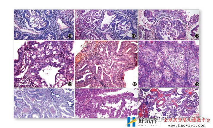 试管婴儿需要什么条件才可以做——系列文1最全面...(图7) 试管婴儿需要什么条件才可以做——系列文1最全面...(图7)