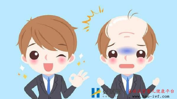 多大年龄都可以植发吗?想植发需要什么条件才可以?(图1) 多大年龄都可以植发吗?想植发需要什么条件才可以?(图1)