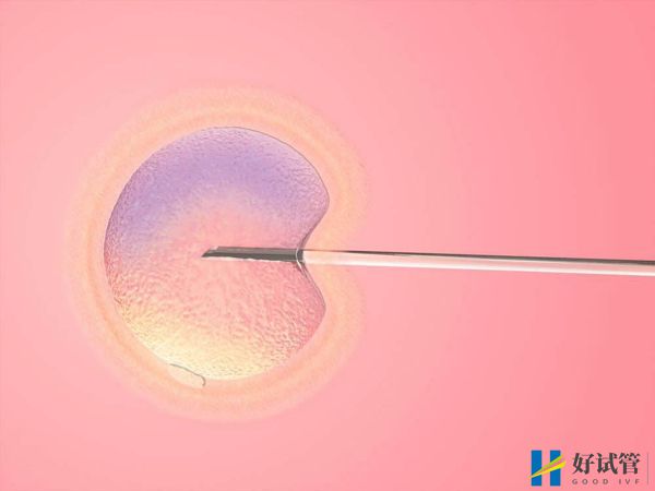上海交通大学医学院附属瑞金医院(图4) 医院试管婴儿成功率