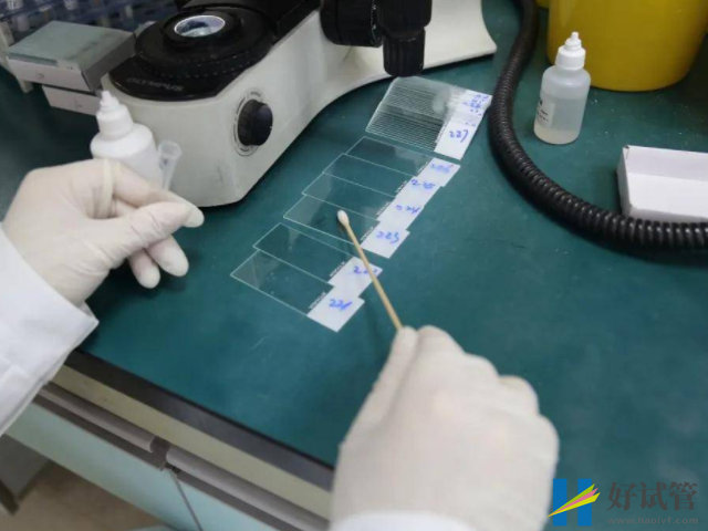 子宫息肉最佳治疗方法有3种,单靠中医调理效果不理想(图3) 子宫息肉需要及时诊治