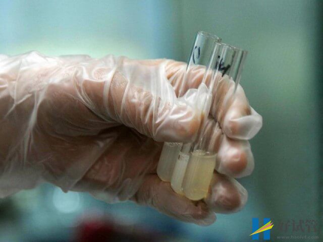 德宏要准备多少钱做第三代试管婴儿,哪家医院好?(图1) 德宏要准备多少钱做第三代试管婴儿,哪家医院好?(图1)