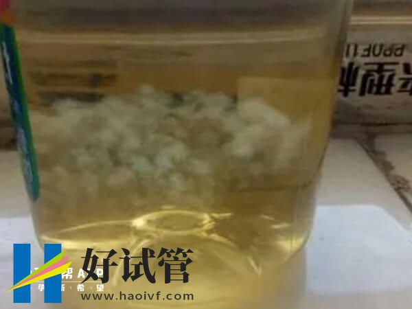 75%酒精测出女宝宝的状态