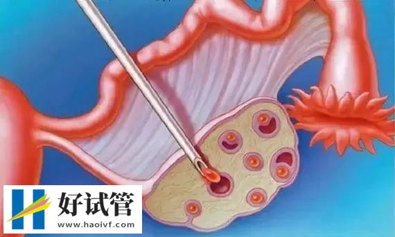 试管助孕准爸妈会有哪些认知误区?(图2) 4684290a8d7dbfc417b5a5f15d948847_640_wx_fmt=jpeg&tp=webp&wxfrom=5&wx_lazy=1&wx_co=1.webp