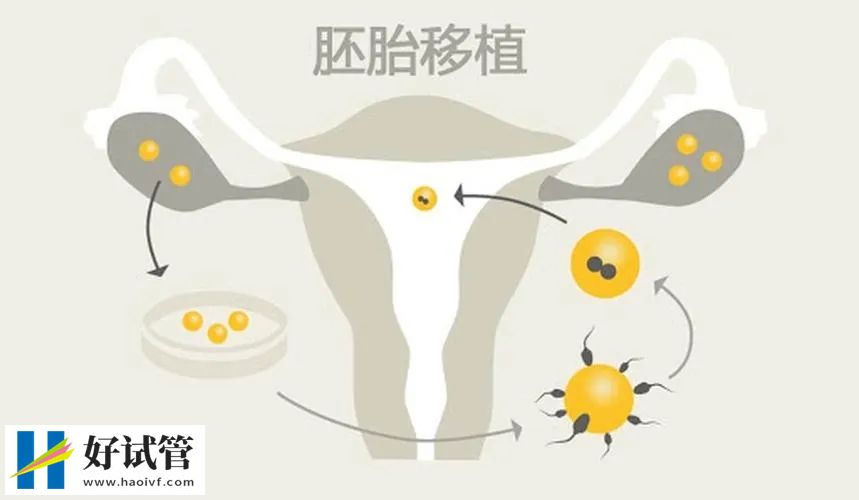 试管助孕准爸妈会有哪些认知误区?(图4) 1d93fa4e0437b75aecd90bea05d08ed8_640_wx_fmt=jpeg&from=appmsg&tp=webp&wxfrom=5&wx_lazy=1&wx_co=1.webp