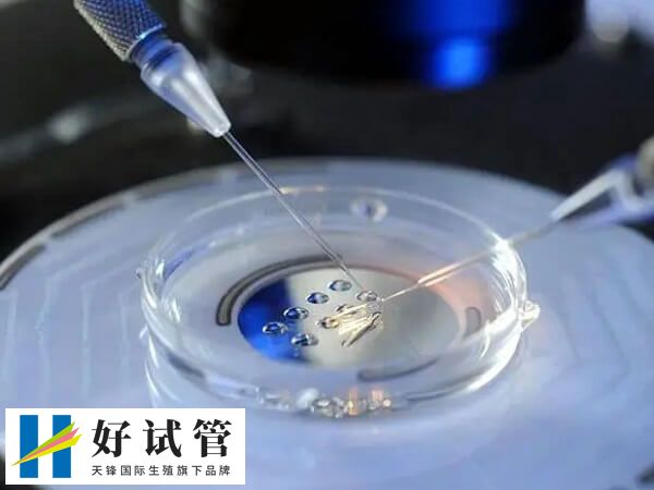 移植胚胎的质量好可提高龙凤胎生育几率