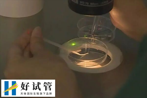 为什么不建议正常女性做试管婴儿(图2) 取卵会对卵巢造成刺激和损伤