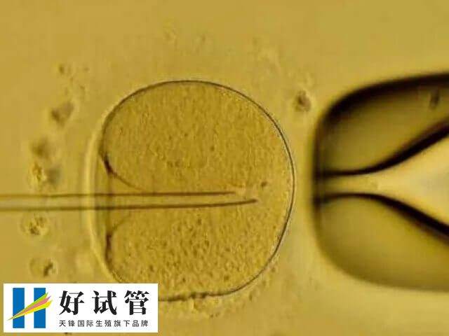 5天囊胚和3天鲜胚有哪些区别(图2) 囊胚移植成功率高