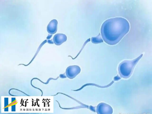 骨髓移植后做试管多少钱(图2) 促排卵之后就可以进行取卵取精了