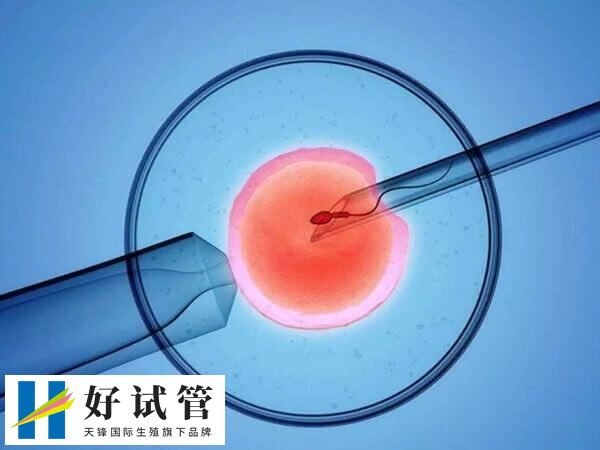 试管婴儿手术前需要取卵