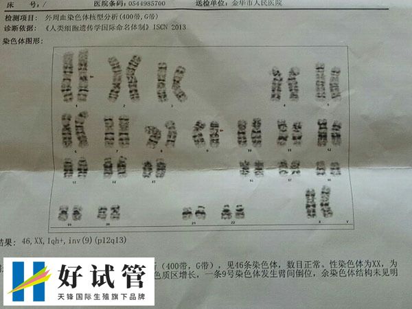 染色体多态可不可以做第三代试管(图2) 染色体多态性是一种正常现象