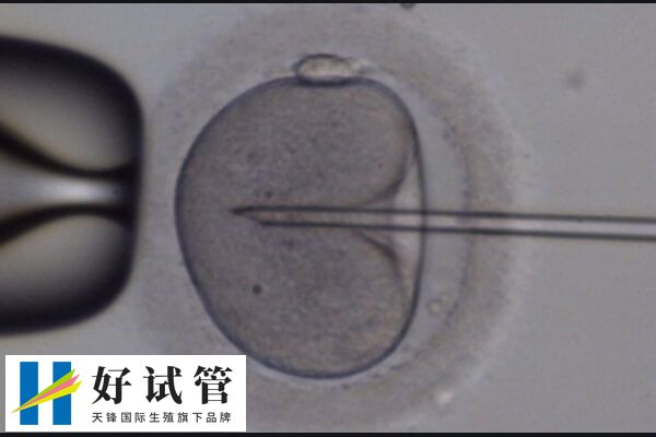 促排卵泡质量不好的原因有哪些(图1) 年龄越高卵子质量可能变差