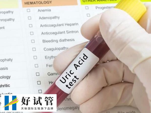 试管促排促黄体生成素是不是越低越好(图1) 促黄体生成素LH并非越低越好